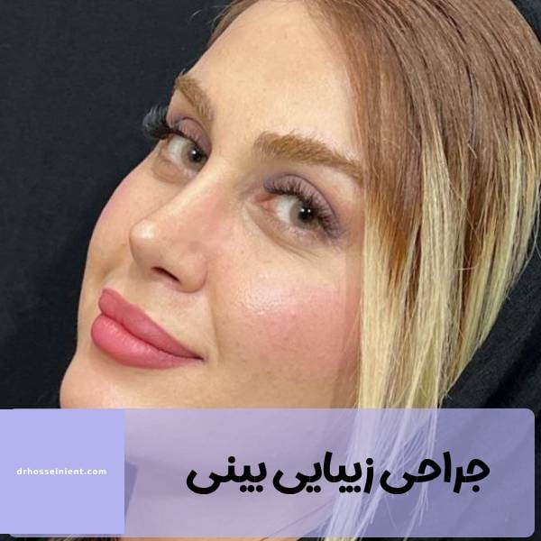 عکس بینی عمل شده - دکتر محمد علی حسینی -drhosseinient.com