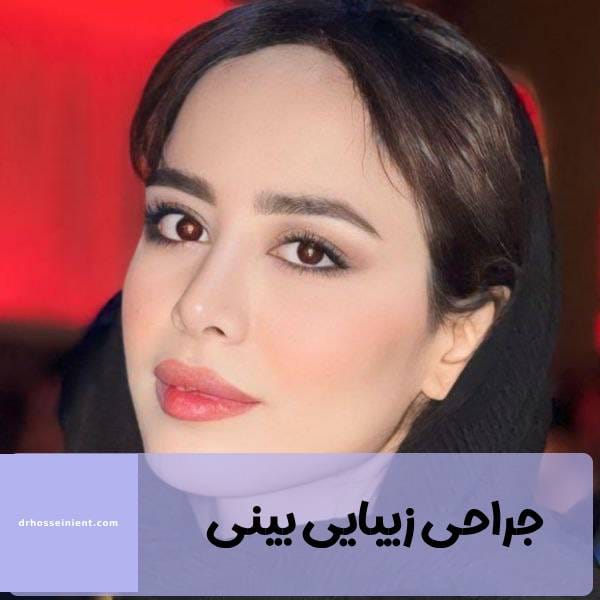 عمل زیبایی بینی- دکتر محمد علی حسینی - drhosseinient.com