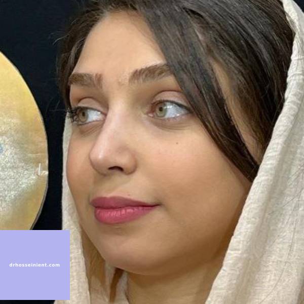 عکس عمل بینی- دکتر محمد علی حسینی - drhosseinient.com