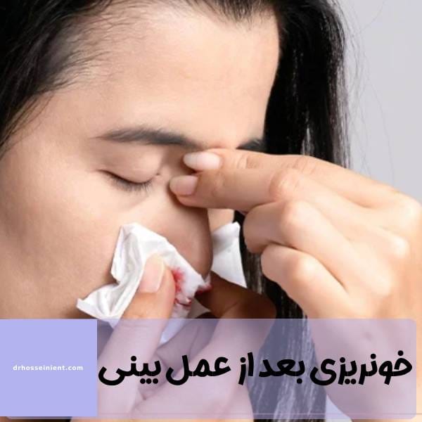 خونریزی بعد از جراحی بینی