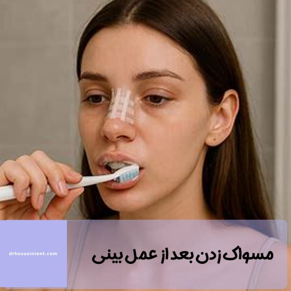 مسواک زدن بعد از عمل بینی - دکتر محمد علی حسینی - drhosseinient.com