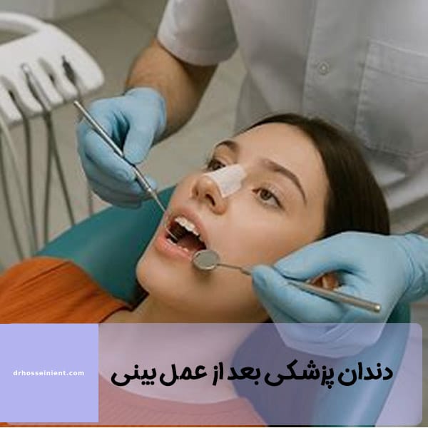 دندانپزشکی بعد از عمل بینی - دکتر محمد علی حسینی - drhosseinient.com