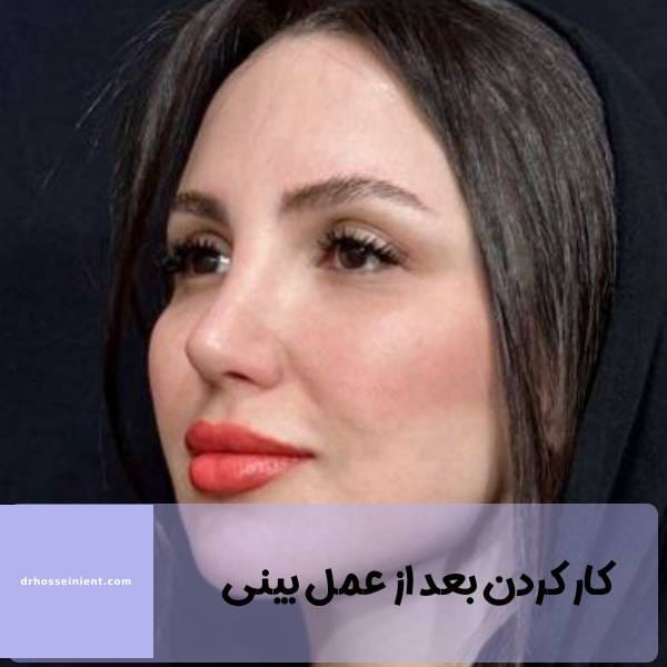 کار کردن بعد از عمل بینی