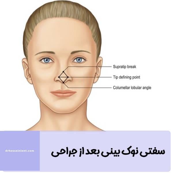 سفت شدن نوک بینی بعد از جراحی