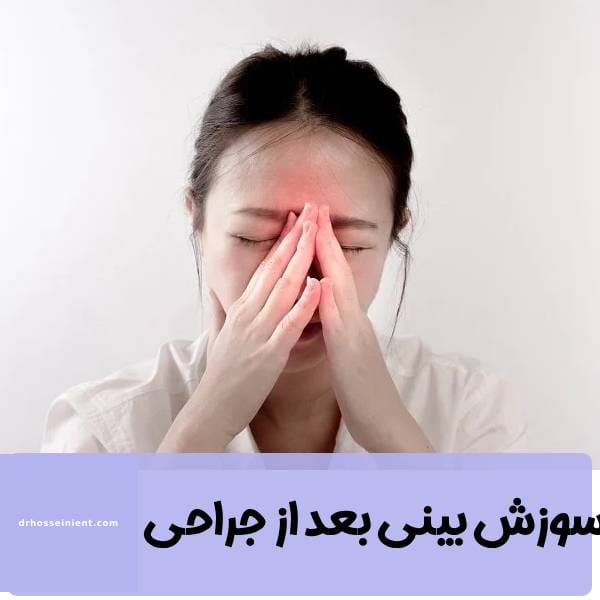سوزش بینی بعد از جراحی