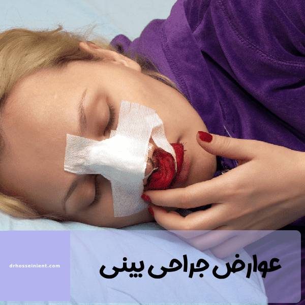 عوارض موقت عمل بینی