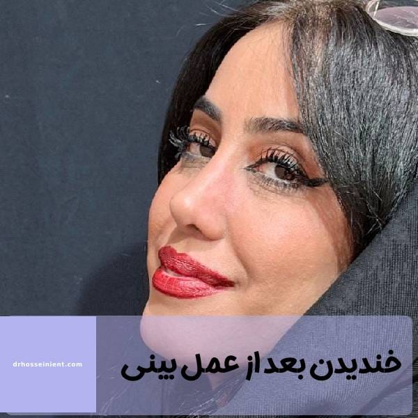 خندیدن بعد از جراحی