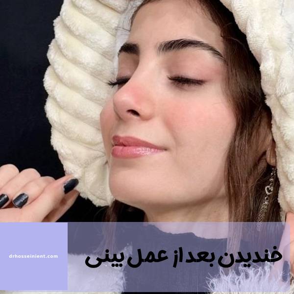 خنده بعد از عمل بینی