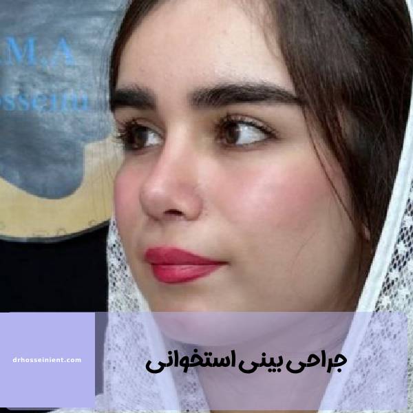 جراحی بینی استخوانی در خوزستان
