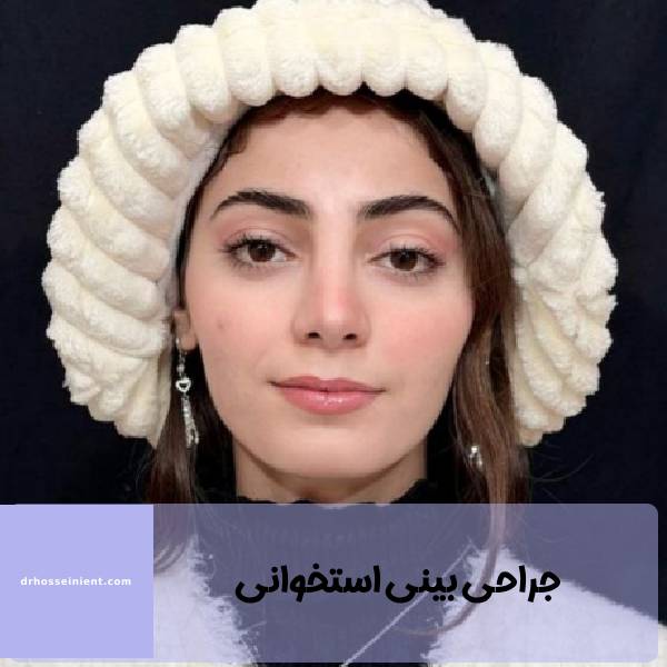 عمل بینی استخوانی | دکتر محمدعلی حسینی
