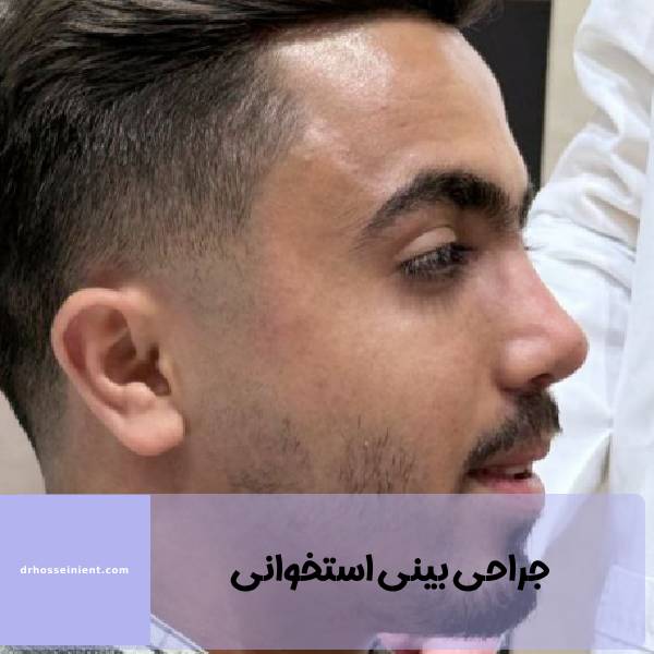 جراحی بینی استخوانی در اهواز