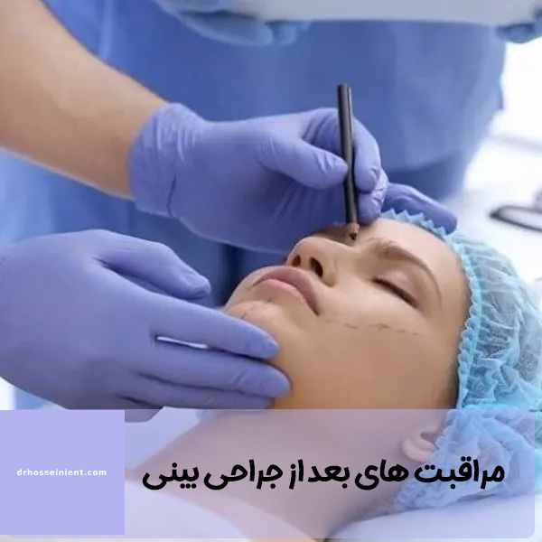 مراقبت های بعد از جراحی بینی