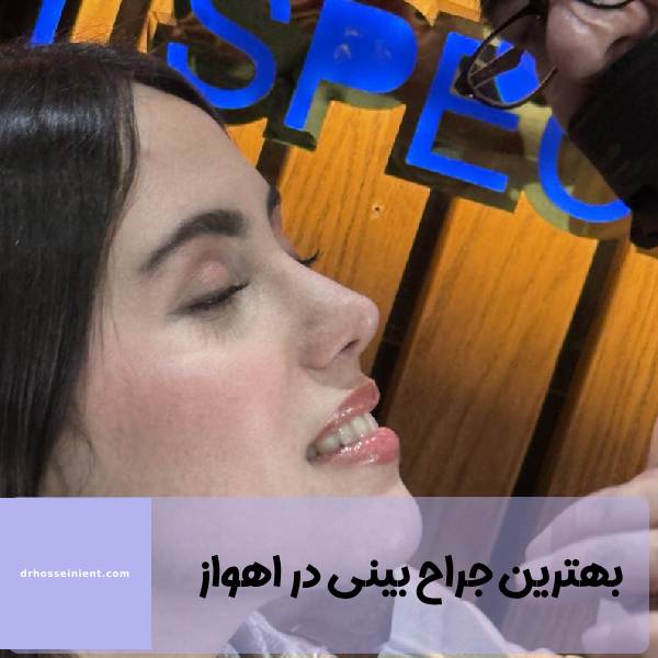 دکتر عمل بینی اهواز خوزستان