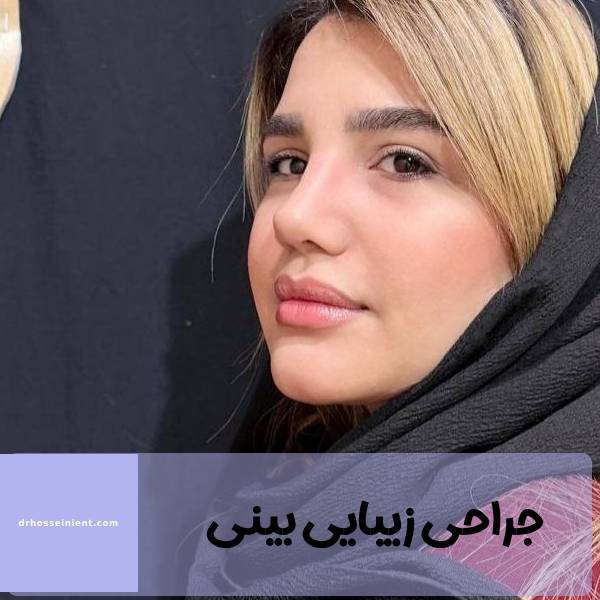 نمونه عمل بینی در اهواز