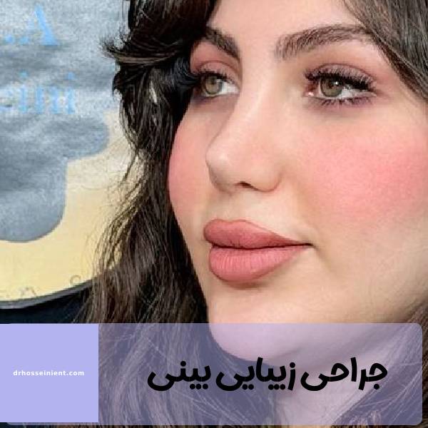 عمل زیبایی بینی بینی در خوزستان