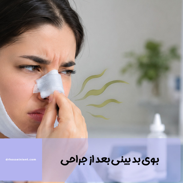بوی بد بینی بعد از جراحی - دکتر حسینی