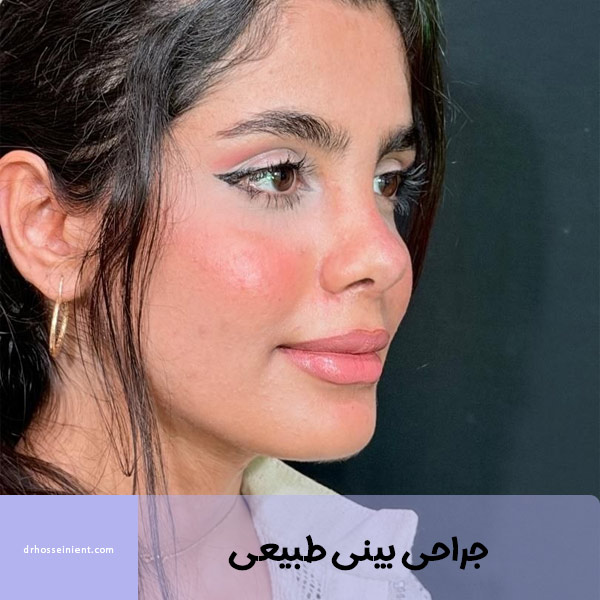 عمل بینی طبیعی در اهواز - دکتر محمدعلی حسینی