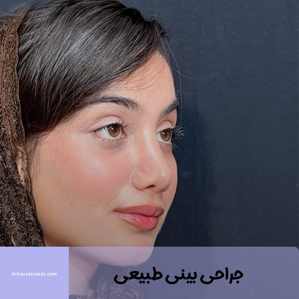 جراحی بینی طبیعی - دکتر محمدعلی حسینی