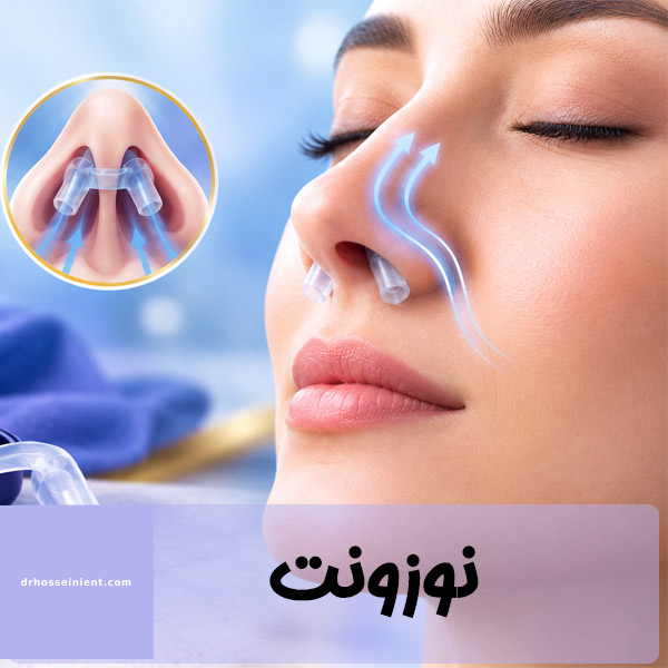نوزونت بینی - دکتر محمدعلی حسینی