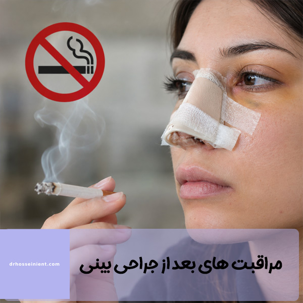 سیگار کشیدن بعد از عمل بینی - دکتر حسینی
