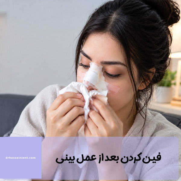 فین کردن بعد از عمل بینی - دکتر حسینی