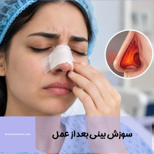 علت سوزش بینی بعد از عمل - دکتر حسینی