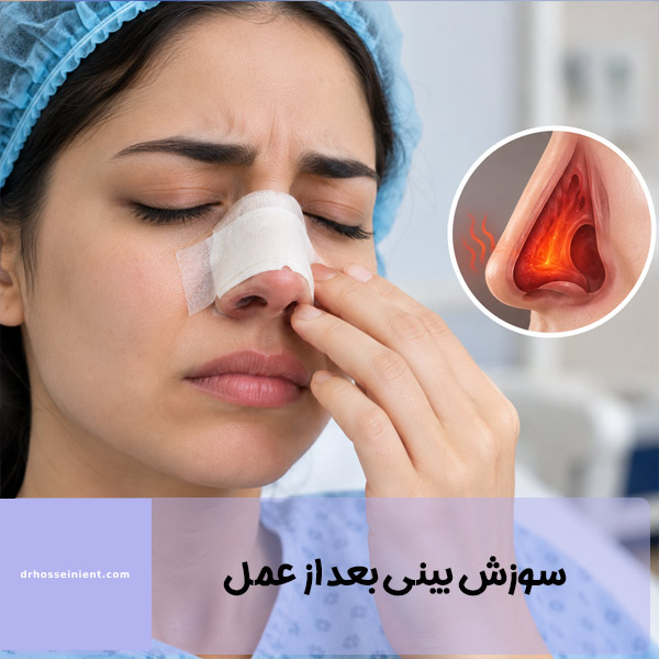 علت سوزش بینی بعد از عمل - دکتر حسینی