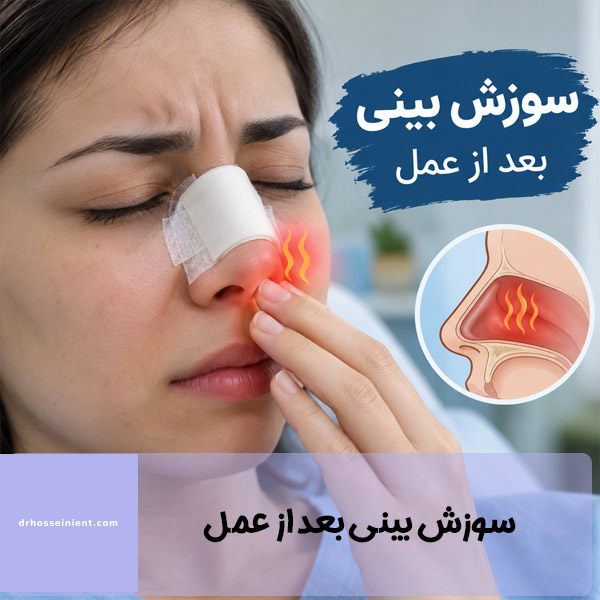 علت سوزش بینی بعد از عمل - دکتر حسینی