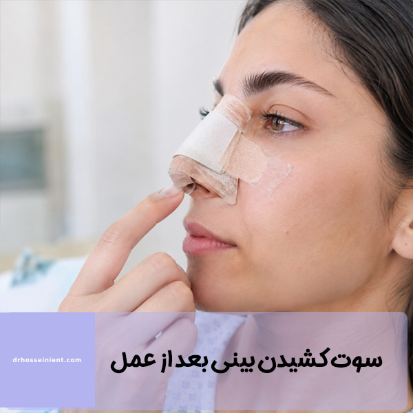 سوت کشیدن بینی بعد از عمل - دکتر حسینی
